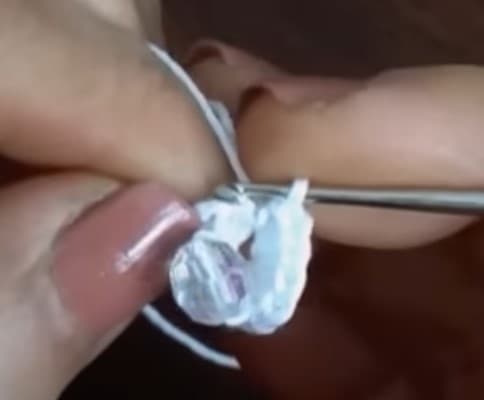 Step 5